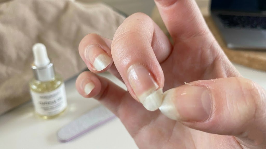 short natural nails being examined close up with cuticle oil dropper bottle and nail file in background
