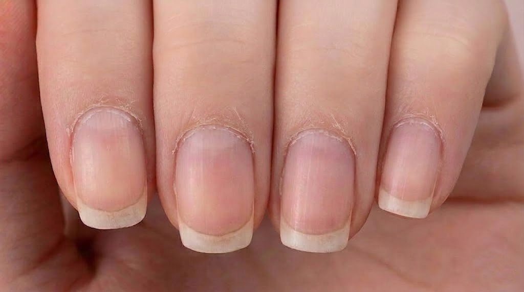 Close-up of overgrown cuticles on natural unpainted nails before being pushed back